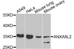 Western blot analysis of extracts of various cell lines, using ANXA8L2 antibody (ABIN5975720) at 1/1000 dilution.