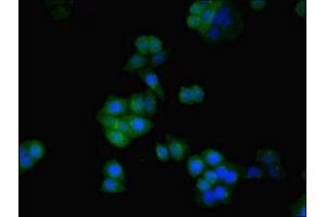 Immunofluorescent analysis of PC-3 cells using ABIN7170882 at dilution of 1:100 and Alexa Fluor 488-congugated AffiniPure Goat Anti-Rabbit IgG(H+L) (SDHA 抗体  (AA 44-293))