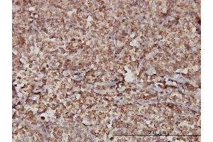 Immunostaining (ISt) image for anti-Stromal Interaction Molecule 1 (STIM1) (AA 24-685) antibody (ABIN563045)