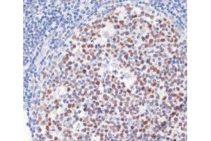 Immunohistochemistry of paraffin-embedded Human tonsil using DNMT1 Polyclonal Antibody at dilution of 1:200 (40x lens). (DNMT1 抗体)
