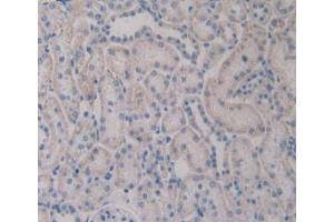 IHC-P analysis of Rat Kidney Tissue, with DAB staining. (TLR4 抗体  (AA 49-247))