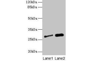 Western blot All lanes: IGFBP1 antibody at 3 μg/mL Lane 1: A549 whole cell lysate Lane 2: PC-3 whole cell lysate Secondary Goat polyclonal to rabbit IgG at 1/10000 dilution Predicted band size: 28 kDa Observed band size: 28 kDa (IGFBPI 抗体  (AA 26-259))