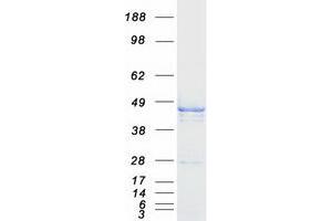 CBWD1 Protein (Transcript Variant 1) (Myc-DYKDDDDK Tag)