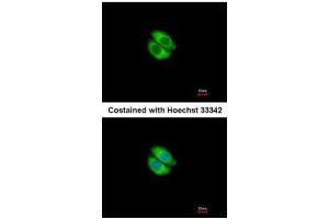 ICC/IF Image Immunofluorescence analysis of methanol-fixed A549, using Syntrophin alpha 1, antibody at 1:500 dilution. (SNTA1 抗体)