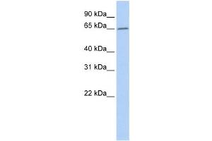 Western Blotting (WB) image for anti-Acyl-CoA Thioesterase 12 (ACOT12) antibody (ABIN2459539) (ACOT12 抗体)