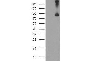 HEK293T cells were transfected with the pCMV6-ENTRY control (Left lane) or pCMV6-ENTRY TFR2 (Right lane) cDNA for 48 hrs and lysed. (Transferrin Receptor 2 抗体)