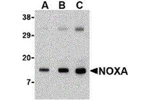 Western Blotting (WB) image for anti-Phorbol-12-Myristate-13-Acetate-Induced Protein 1 (PMAIP1) (N-Term) antibody (ABIN2475927) (NOXA 抗体  (N-Term))