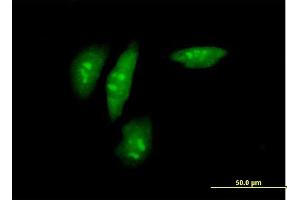 Immunofluorescence of purified MaxPab antibody to SRPK2 on HeLa cell. (SRPK2 抗体  (AA 1-699))
