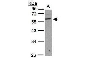 WB Image Sample(30 ug whole cell lysate) A:293T 10% SDS PAGE antibody diluted at 1:1000 (B3GNT3 抗体)