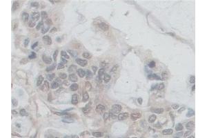 Immunohistochemistry (IHC) image for anti-NADPH Oxidase 5 (NOX5) (AA 456-765) antibody (ABIN7444193)