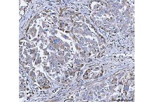 IHC analysis of DOCK180/DOCK1 using anti-DOCK180/DOCK1 antibody (ABIN7599615).