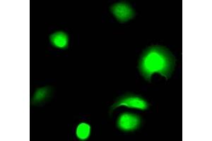 Immunofluorescence staining of MCF7 Cells with ABIN7127508 at 1:50, counter-stained with DAPI. (Recombinant Galectin 3 抗体)
