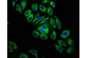Immunofluorescence staining of A549 cells with ABIN7156494 at 1:133, counter-stained with DAPI. (ITGB6 抗体  (AA 451-586))