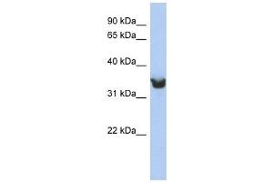 DLK1 antibody used at 1 ug/ml to detect target protein. (DLK1 抗体)