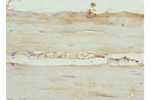 Immunohistochemistry of paraffin-embedded human skeletal muscle tissue using ABIN7145725 at dilution of 1:100