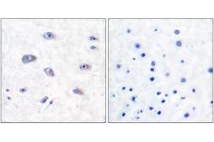 Immunohistochemistry analysis of paraffin-embedded human brain tissue, using BACE (Ab-498) Antibody. (BACE1 抗体  (AA 452-501))
