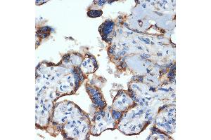 Immunohistochemistry of paraffin-embedded human placenta using NLK Rabbit mAb (ABIN7268846) at dilution of 1:100 (40x lens). (Nemo-Like Kinase 抗体)