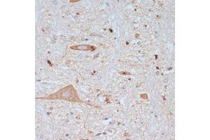 Immunohistochemistry (IHC) image for anti-Solute Carrier Family 18 (Vesicular Acetylcholine), Member 3 (SLC18A3) (AA 1-150) antibody (ABIN7270410)
