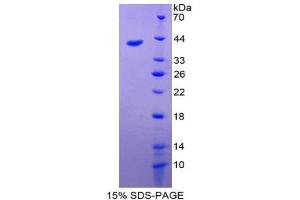 SDS-PAGE (SDS) image for Eosinophil Chemotactic Factor (ECF) (AA 24-97) protein (His tag,GST tag) (ABIN1980608)