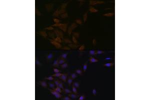 Immunofluorescence analysis of C6 cells using PP2A alpha + beta Rabbit mAb (ABIN7269686) at dilution of 1:100 (40x lens).