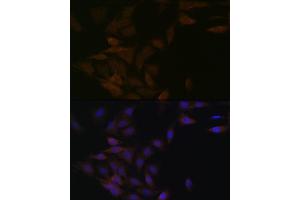 Immunofluorescence analysis of C6 cells using PP2A alpha + beta Rabbit mAb (ABIN7269686) at dilution of 1:100 (40x lens). (PPP2CB 抗体)
