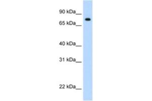 Western Blotting (WB) image for anti-Signal Transducer and Activator of Transcription 1, 91kDa (STAT1) antibody (ABIN2461816) (STAT1 抗体)