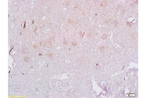 Formalin-fixed and paraffin embedded rat brain labeled with Rabbit Anti ADRB3/beta 3 Adrenergic Receptor Polyclonal Antibody, Unconjugated  at 1:200 followed by conjugation to the secondary antibody and DAB staining (ADRB3 抗体  (AA 310-408))