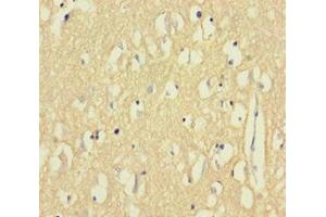 Immunohistochemistry of paraffin-embedded human brain tissue using ABIN7145308 at dilution of 1:100 (BCL2L2 抗体  (AA 2-193))