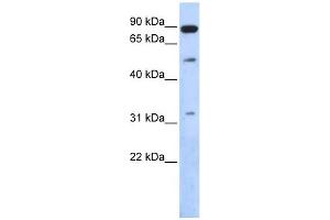 SENP5 antibody used at 1 ug/ml to detect target protein. (SENP5 抗体  (Middle Region))