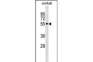 SF3A2 Antibody (Center) (ABIN1881795 and ABIN2838933) western blot analysis in Jurkat cell line lysates (35 μg/lane). (SF3A2 抗体  (AA 166-194))