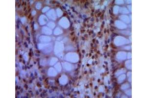 Immunohistochemical analysis of paraffin-embedded human colon using SMC1 mouse mAb with DAB staining.