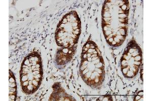 Immunoperoxidase of monoclonal antibody to SRPK1 on formalin-fixed paraffin-embedded human colon. (SRPK1 抗体  (AA 371-470))