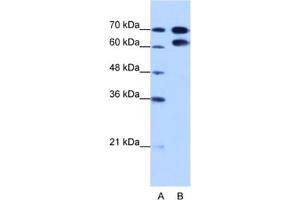 Western Blotting (WB) image for anti-Ribonucleoprotein, PTB-Binding 1 (RAVER1) antibody (ABIN2462325) (RAVER1 抗体)