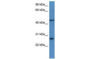 Image no. 1 for anti-Fibroblast Growth Factor Binding Protein 2 (FGFBP2) (C-Term) antibody (ABIN6746863) (FGFBP2 抗体  (C-Term))