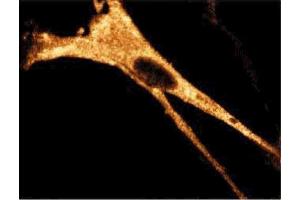Immunofluorescence staining of WI-38 cells (Human lung fibroblasts, ATCC CCL-75). (RIPK1 抗体  (AA 385-650))