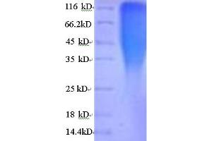 SDS-PAGE (SDS) image for Corticotropin Releasing Hormone Receptor 1 (CRHR1) (AA 23-121) protein (His tag) (ABIN5713378)