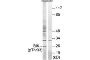 Western blot analysis of extracts from K562 cells, using BIK (Phospho-Thr33) Antibody. (BIK 抗体  (pThr33))