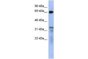 WB Suggested Anti-RAP1GAP  Antibody Titration: 0. (RAP1GAP 抗体  (Middle Region))