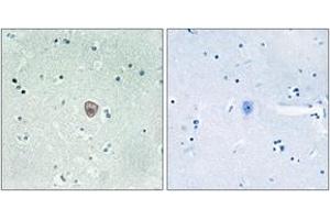 Immunohistochemistry analysis of paraffin-embedded human brain tissue, using EDG8 Antibody. (S1PR5 抗体  (AA 335-384))