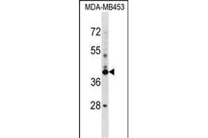 SRRD Antibody (Center) (ABIN1537981 and ABIN2848619) western blot analysis in MDA-M cell line lysates (35 μg/lane). (SRRD 抗体  (AA 184-213))