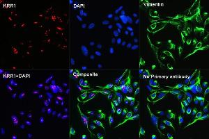 Confocal Immunofluorescence analysis of U2OS cells using KRR1 Rabbit pAb  at dilution of 1:100 (40x lens)(red). (Vimentin 抗体)