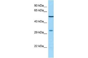 WB Suggested Anti-MAGEA12 Antibody Titration: 1. (MAGEA12 抗体  (N-Term))