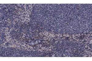 Immunohistochemistry (IHC) image for anti-Mitogen-Activated Protein Kinase Kinase 3 (MAP2K3) (pSer189) antibody (ABIN6256178)