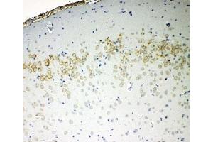 IHC-P: VE-Cadherin antibody testing of rat brain tissue