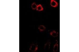 Immunofluorescent analysis of HSD17B2 staining in SW480 cells. (HSD17B2 抗体)