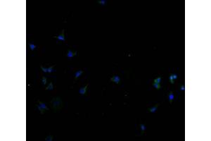 Immunofluorescence staining of SH-SY5Y cells with ABIN7170135 at 1:100, counter-stained with DAPI. (SLC22A10 抗体  (AA 37-145))