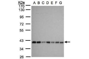 WB Image Sample(30 ug whole cell lysate) A: 293T B: A431 , C: H1299 D: HeLa S3 , E: Hep G2 , F: MOLT4 , G: Raji , 10% SDS PAGE antibody diluted at 1:1000 (SLC25A33 抗体)