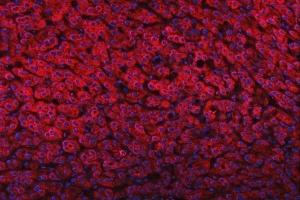 anti-Fatty Acid Desaturase 1 (FADS1) (AA 1-257) antibody