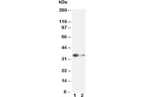 Western blot testing of Arginase 1 antibody and Lane 1:  rat liver ;  2: rat kidney lysate (Liver Arginase 抗体  (AA 307-323))