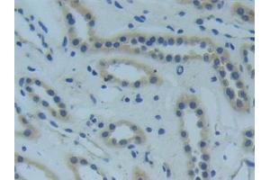 Detection of TNFR1 in Human Kidney Tissue using Polyclonal Antibody to Tumor Necrosis Factor Receptor 1 (TNFR1)